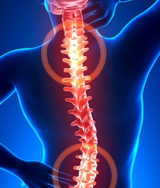 Spine Surgery